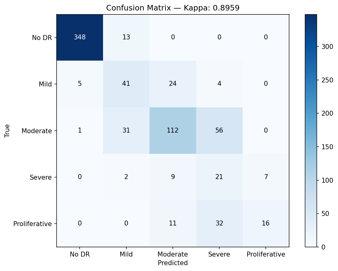 5x5 confusion matrix: AI grade vs expert grade on APTOS hold-out set