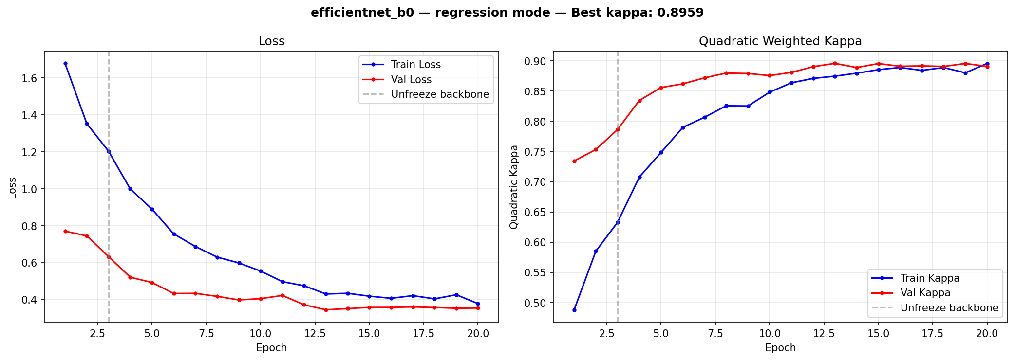 Training loss and QW kappa by epoch over 20 epochs